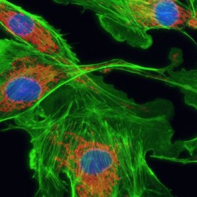 怎么提高顯微鏡的熒光成像的質(zhì)量？